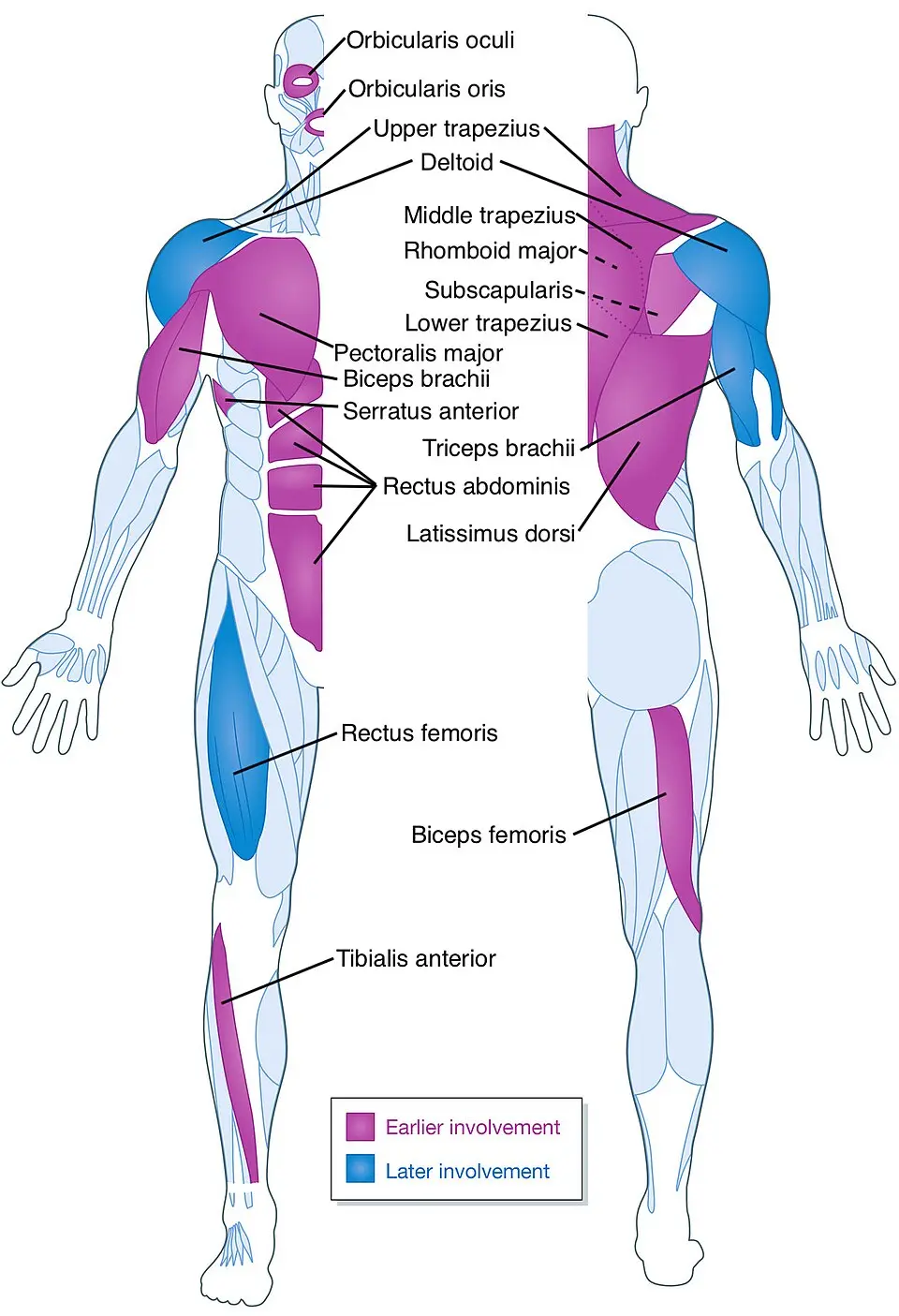 Dystrophie facio-scapulo-humérale (FSHD) et vélo